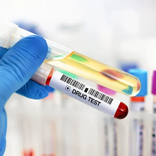 lab tech hand holding urine and blood tube test for analysis for doping or drugs. urinalysis and blood sample for drug test or alcohol in the laboratory
