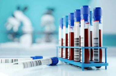 Test tubes with blood specimens sitting in a rack