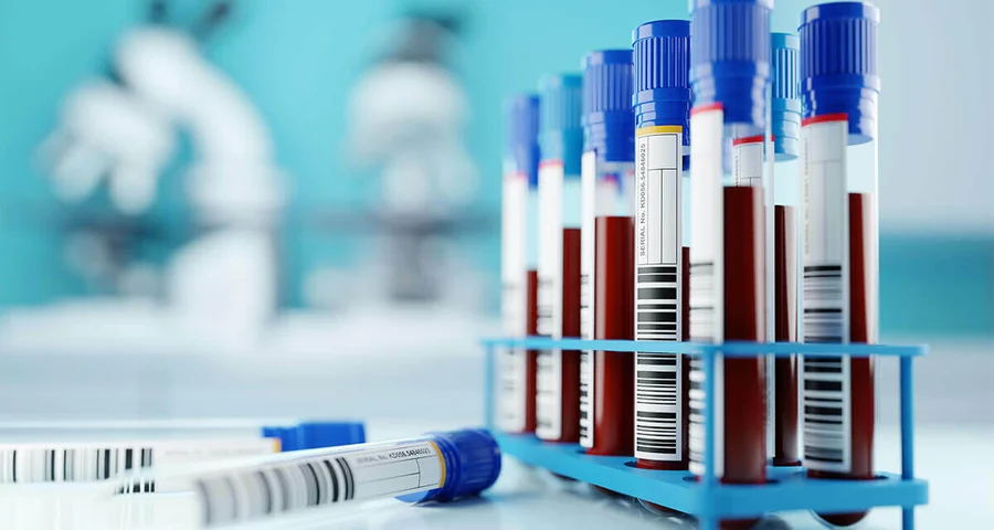 Test tubes with blood specimens sitting in a rack