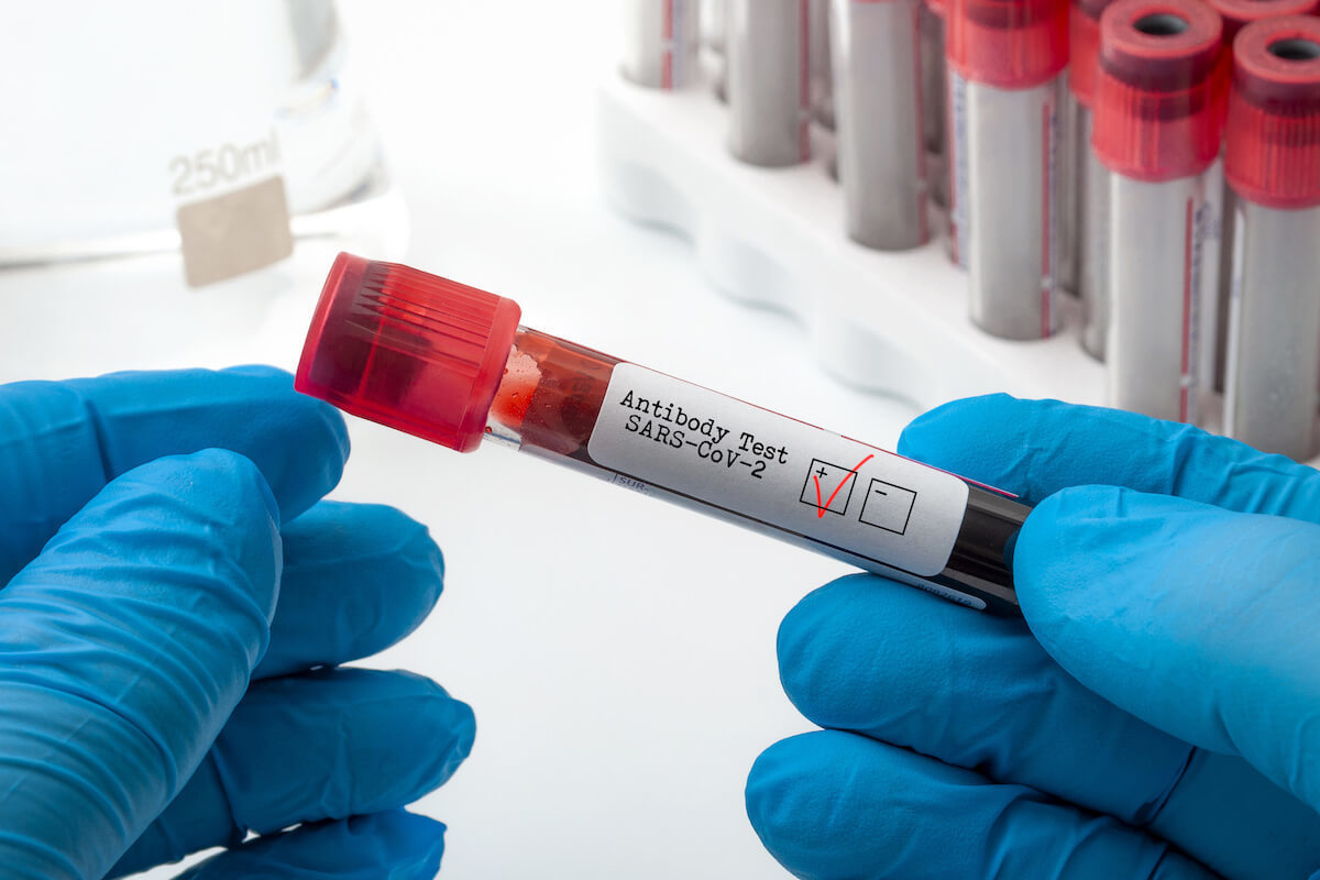 antibody testing