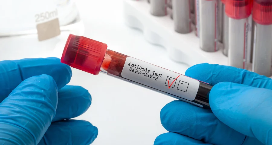 antibody testing