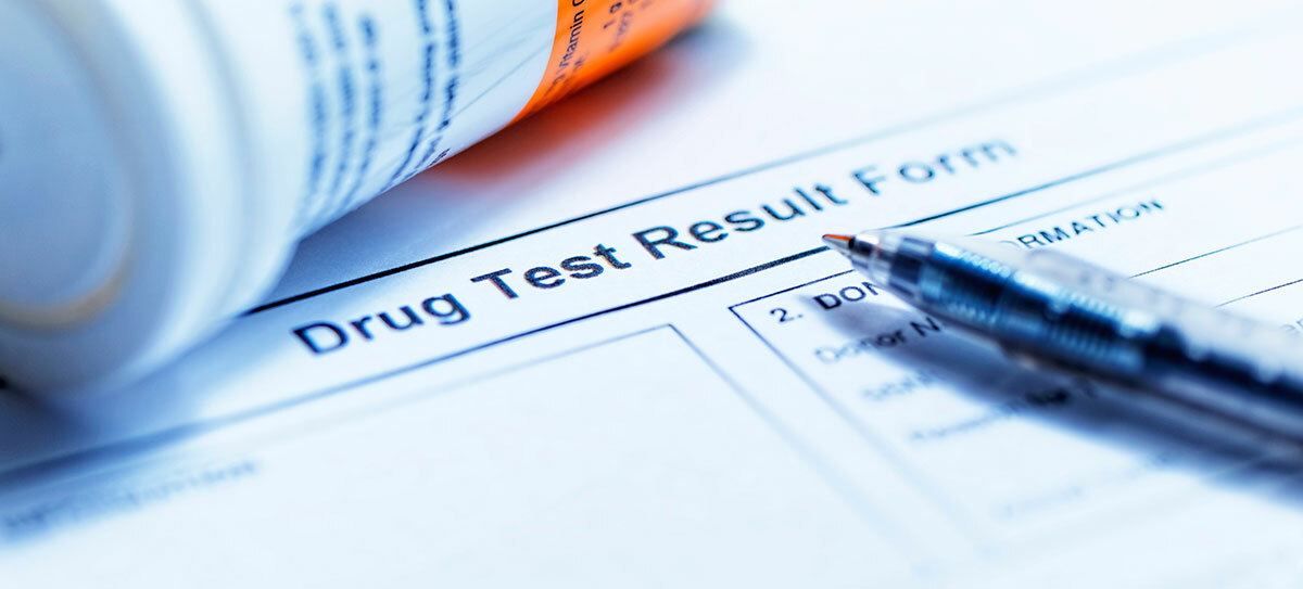 Drug Test Result form