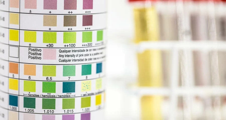 drug testing positivity scale