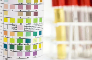 drug testing positivity scale