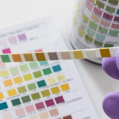 urinalysis test for pre-employment drug test