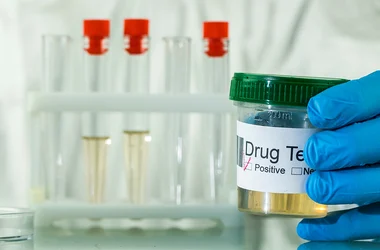 urine analysis drug testing