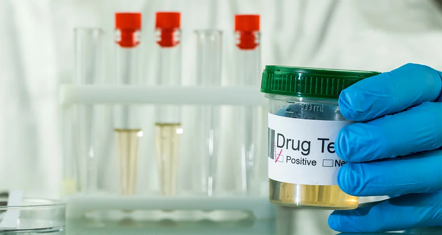 urine analysis drug testing