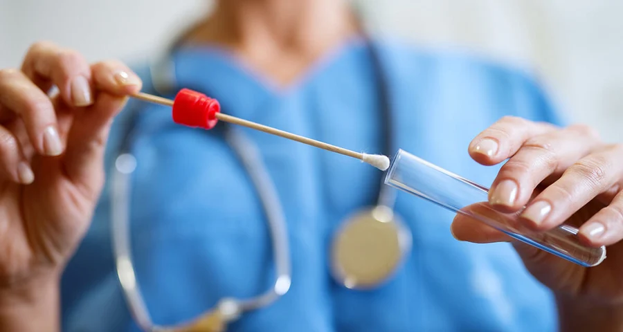 sOral Fluid Swab