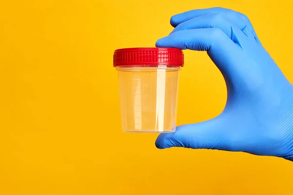 Gloved hands with thumbs up and a drug specimen container