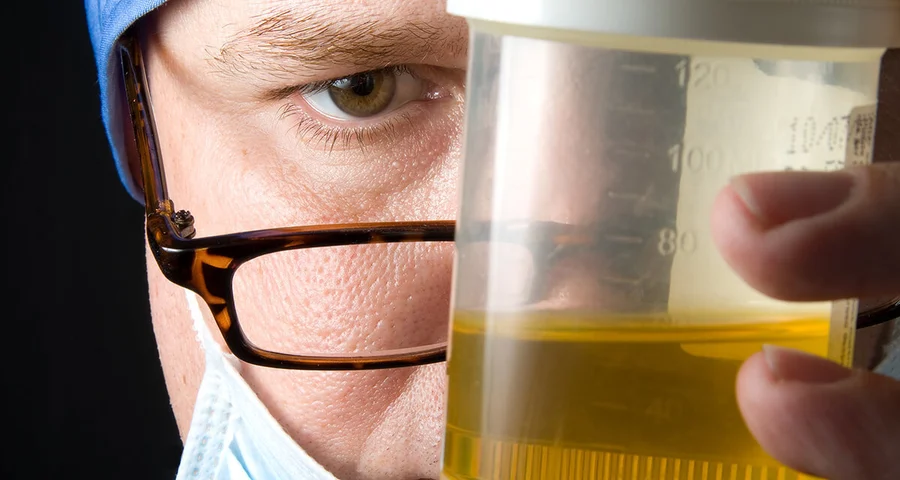 urine analysis doctor