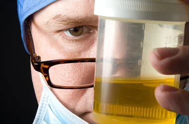 urine analysis doctor