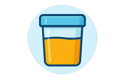 Urine 400x250
